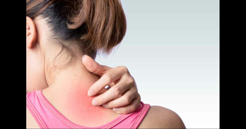 young woman scratching upper back or neck rash on white background