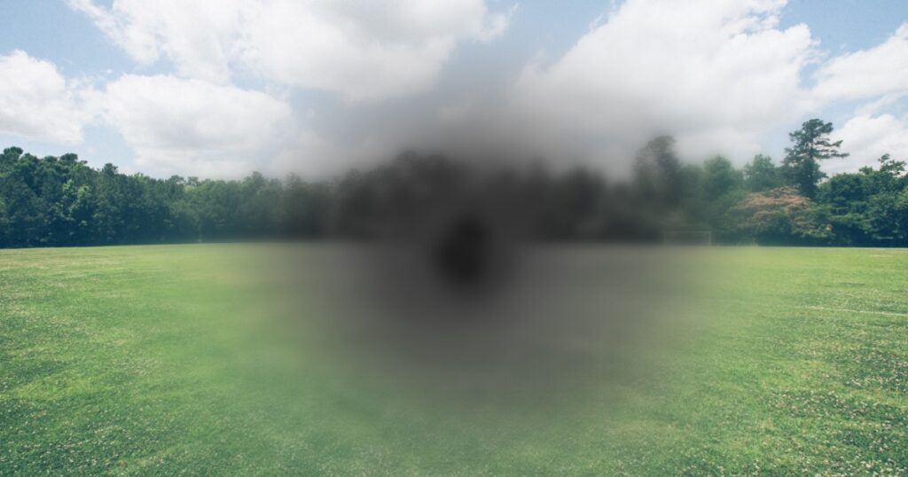 Macular degeneration (AMD or ARMD)- is a medical condition which may result in blurred or no vision in the center of the visual field. It's the leading cause of blindness. Diagnosis in Opthalmology.