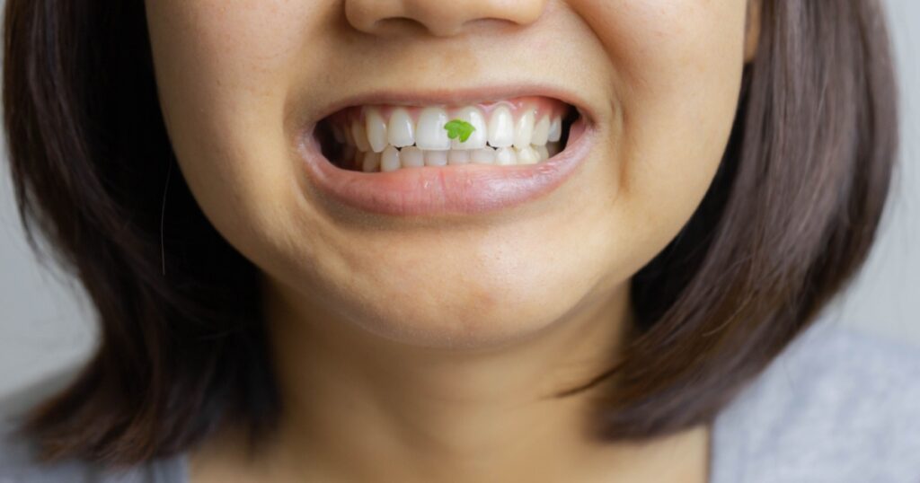 Yong woman show food stuck on teeth.