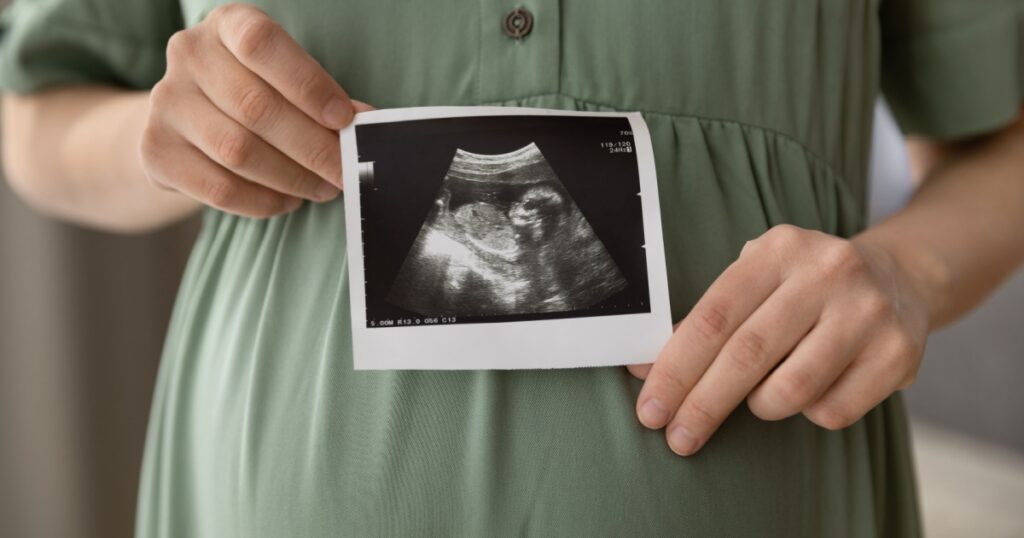 Prenatal ultrasound screening. Cropped close up shot of young pregnant female holding sonogram picture of unborn baby inside her big belly. Happy expectant mom showing fetus usi scan image to camera
