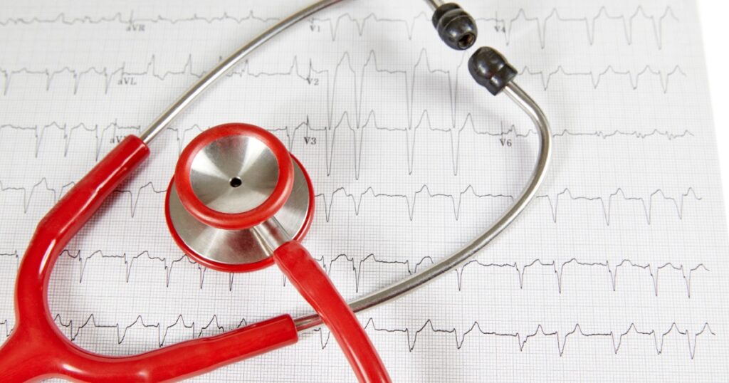Ecocardiography report (ECG)