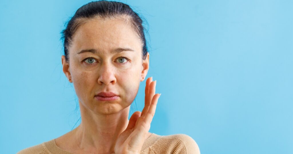 Teeth Problem. Gumboil, flux, bruise and swelling of cheek. Closeup of Beautiful Sad Woman point out on swollen cheeks. Attractive Female Feeling Painful Toothache, Dental Health And Care Concept