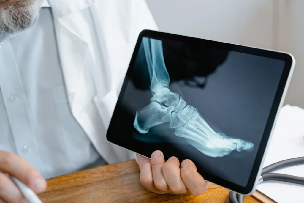 Study Finds Correlation Between Air Pollution and Brittle Bones
