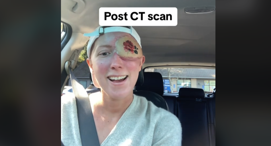 Annika, a 28-year-old woman from California, shares a harrowing tale of battling a deadly sinus cancer