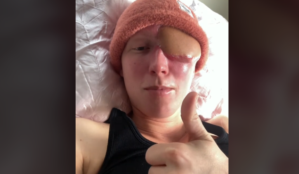 Annika, a 28-year-old woman from California, shares a harrowing tale of battling a deadly sinus cancer