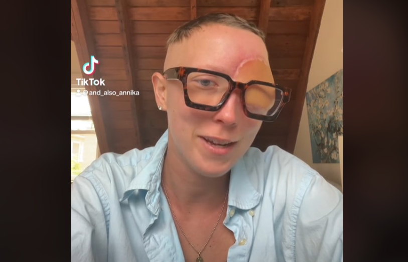 Annika, a 28-year-old woman from California, shares a harrowing tale of battling a deadly sinus cancer