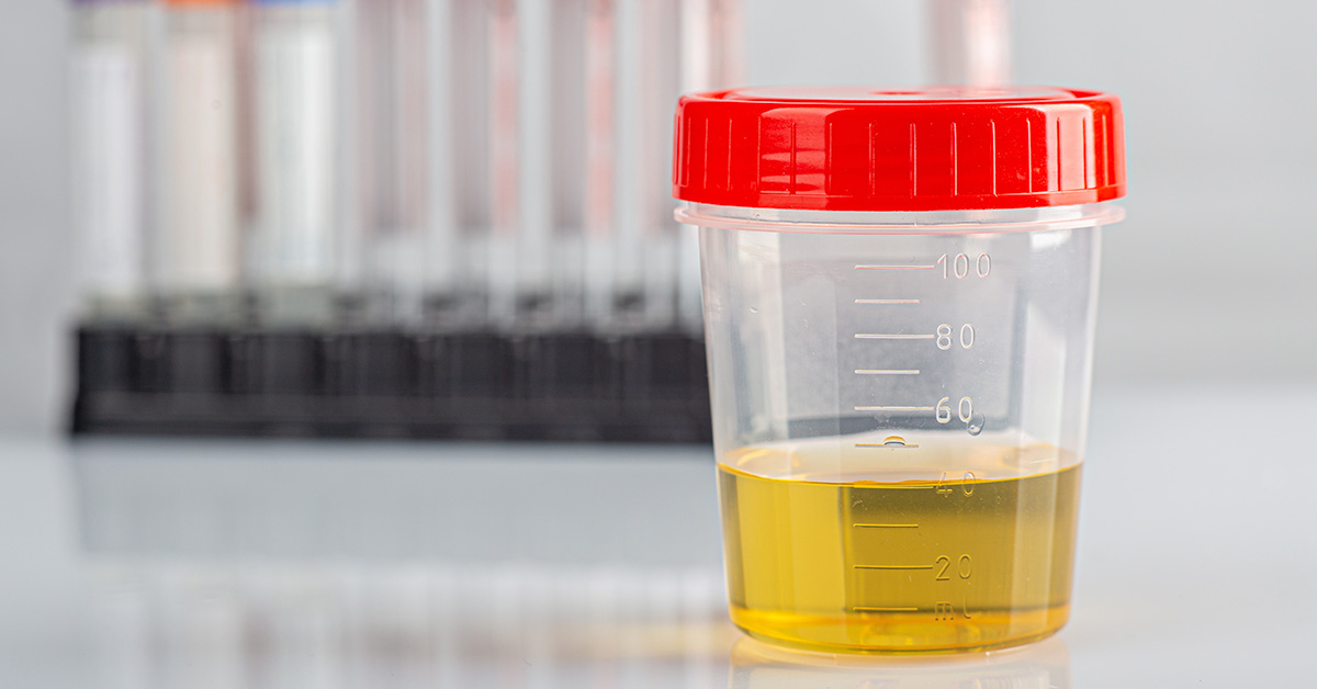 Scientists Discover Concerning Levels of Toxic Material in Human Urine That ‘Raises Important New Questions’