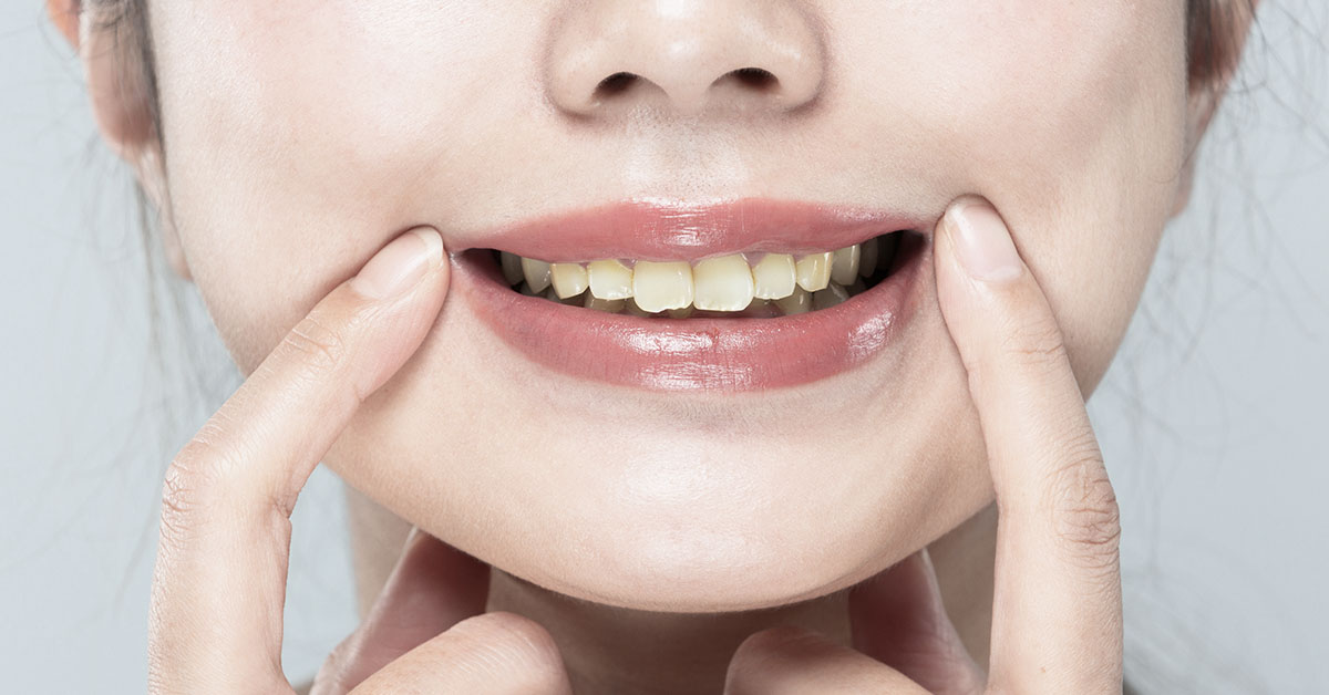 People Often Make This Mistake Which Leads to Yellow Teeth, Dentist Says