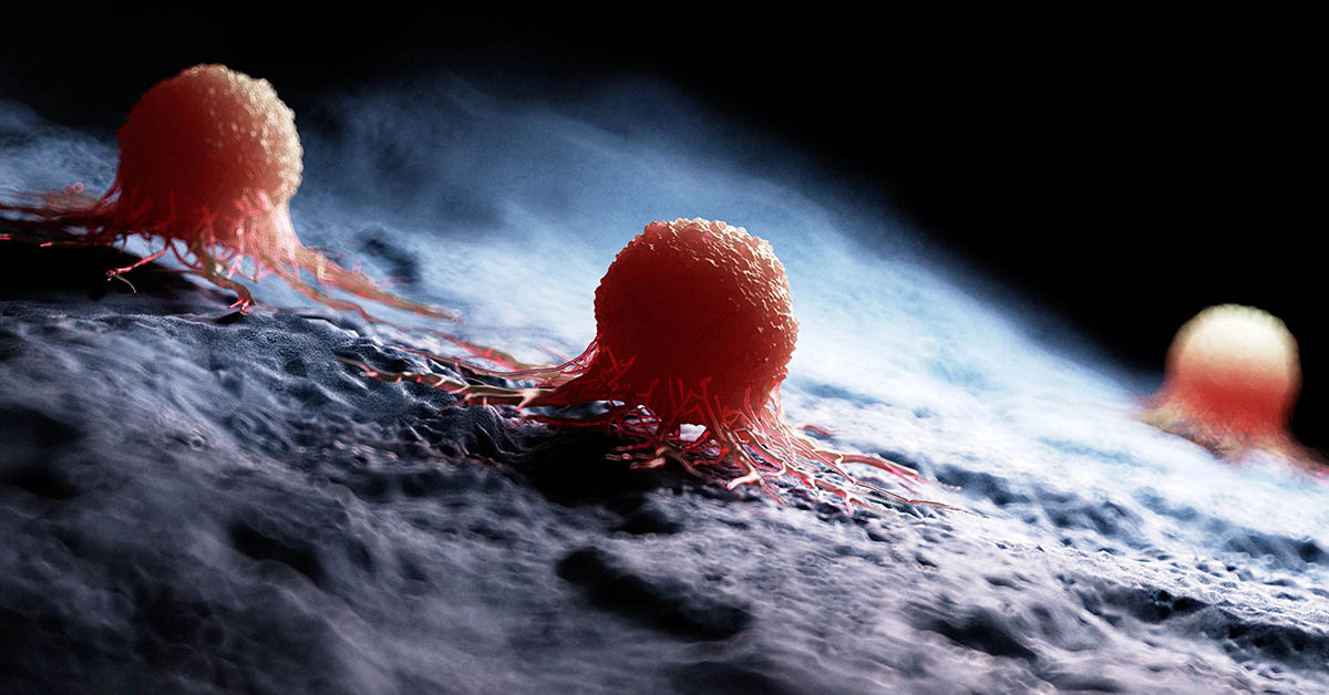 Cancer is Adaptive and Can Switch Sugar for Fatty Acids to Spread Around the Body
