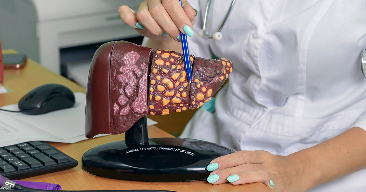 Signs and Symptoms of Liver Cancer Everyone Should Know