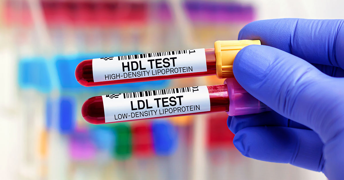 What Happens to Your Cholesterol When You Only Eat One Meal Per Day?