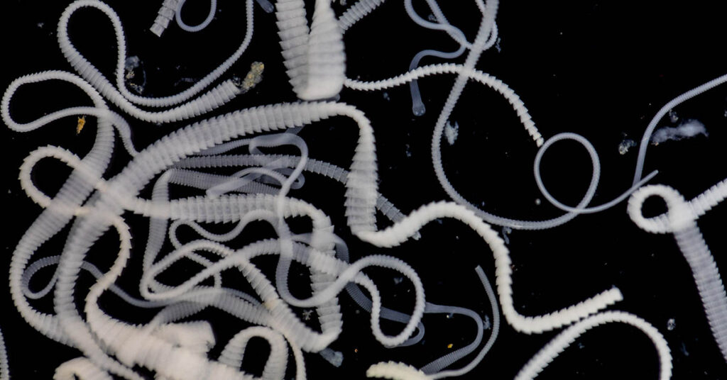 How Do You Know If You Have a Tape Worm? (Symptoms, Causes, and Treatment Options) - Featured image
