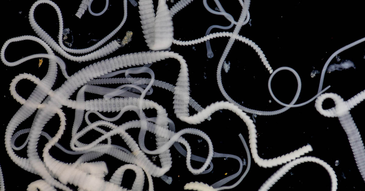 How Do You Know If You Have a Tape Worm? (Symptoms, Causes, and Treatment Options)