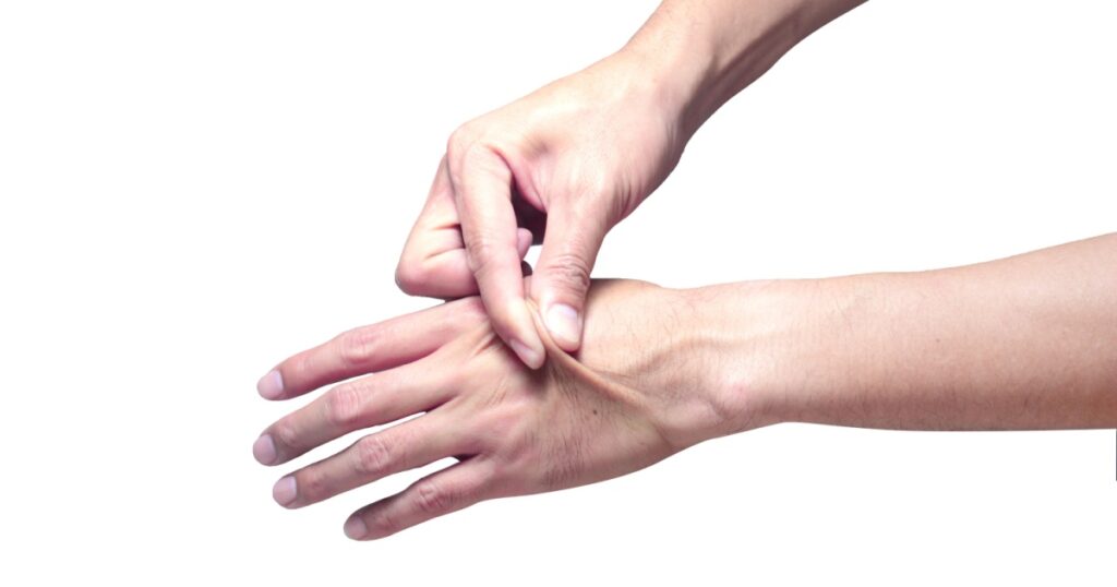 Skin elasticity