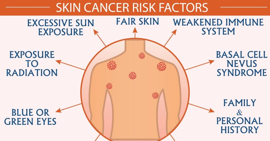 Skin cancer disease risk factors infographic vector illustration. Diagnosis, prevention, symptoms, and treatment concept. Flat style medical template. Hand-drawn awareness month, and health design.