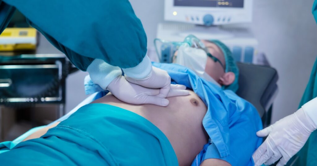 Close-Up on Asian Surgical Team Performing CPR on Heart Attack Patient in Hospital Operating Room
