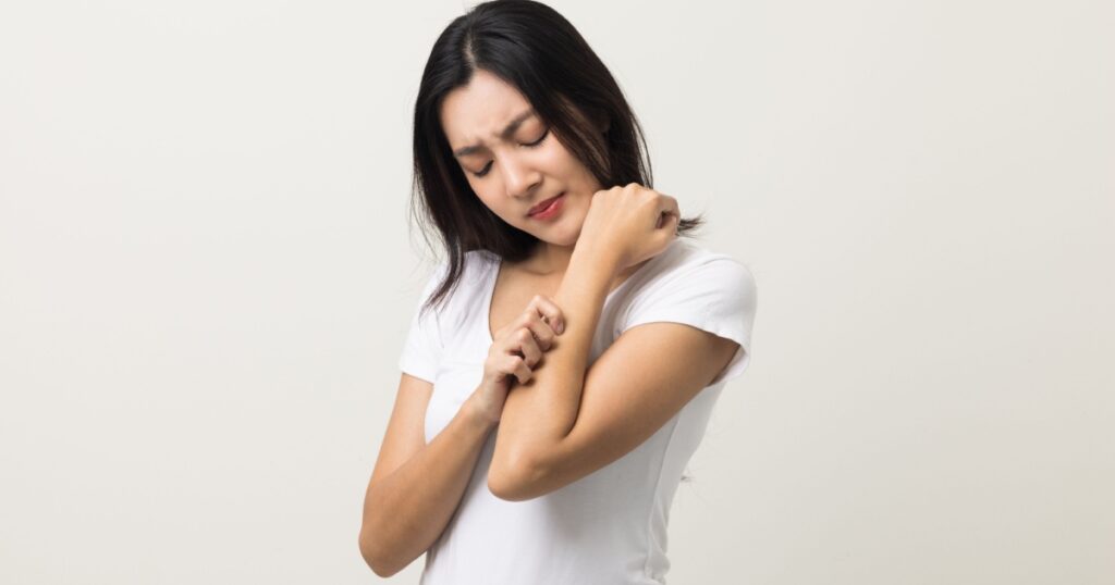 Asian women have skin problems She felt irritation on her skin. Skin infection itching red rash scratching with hands. She around 25 Wearing white shirt standing on isolate background