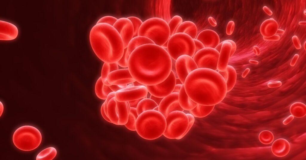 blood clot