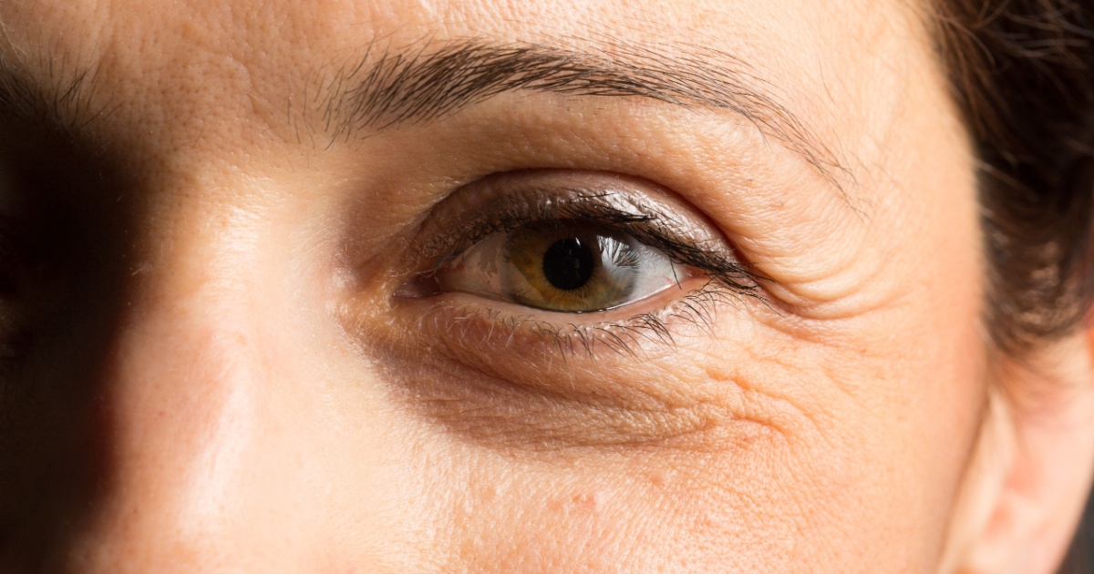 Wrinkles Under Eyes (or on your face) + 11 Ways to Naturally Treat and Help Prevent Wrinkles