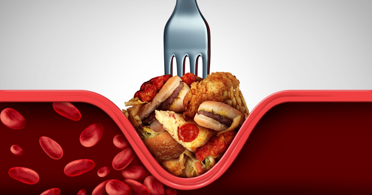 Experts Say These Are The 5 Worst Foods For Your Cholesterol