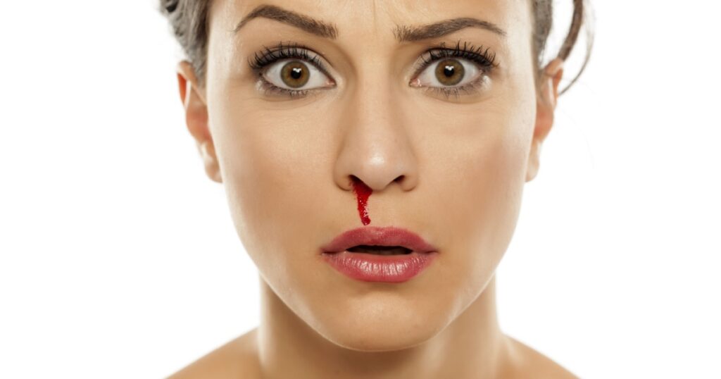 a young confused woman with a bloody nose