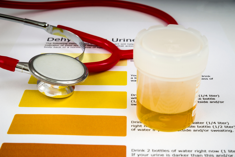 Human Urine Sample
Human urine sample waiting for testing, with a dehydration color chart and transit bag.