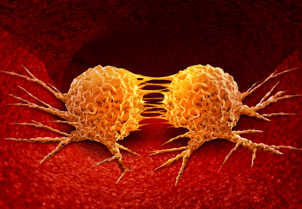 Dividing cancer cell metastasis division as a disease anatomy concept as a growing malignant tumor on an organ inside the human body as a 3D illustration.