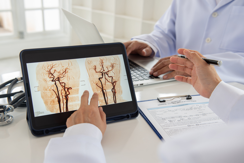doctor team diagnose brain stroke and blood vessels x-ray image for analysis cerebrovascular disease or hemorrhagic stroke by mra brain.
