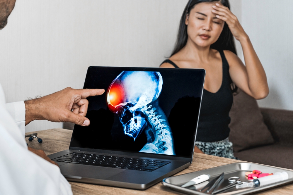 Doctor showing a x-ray of pain in the brain on a laptop. Migraine Headache
