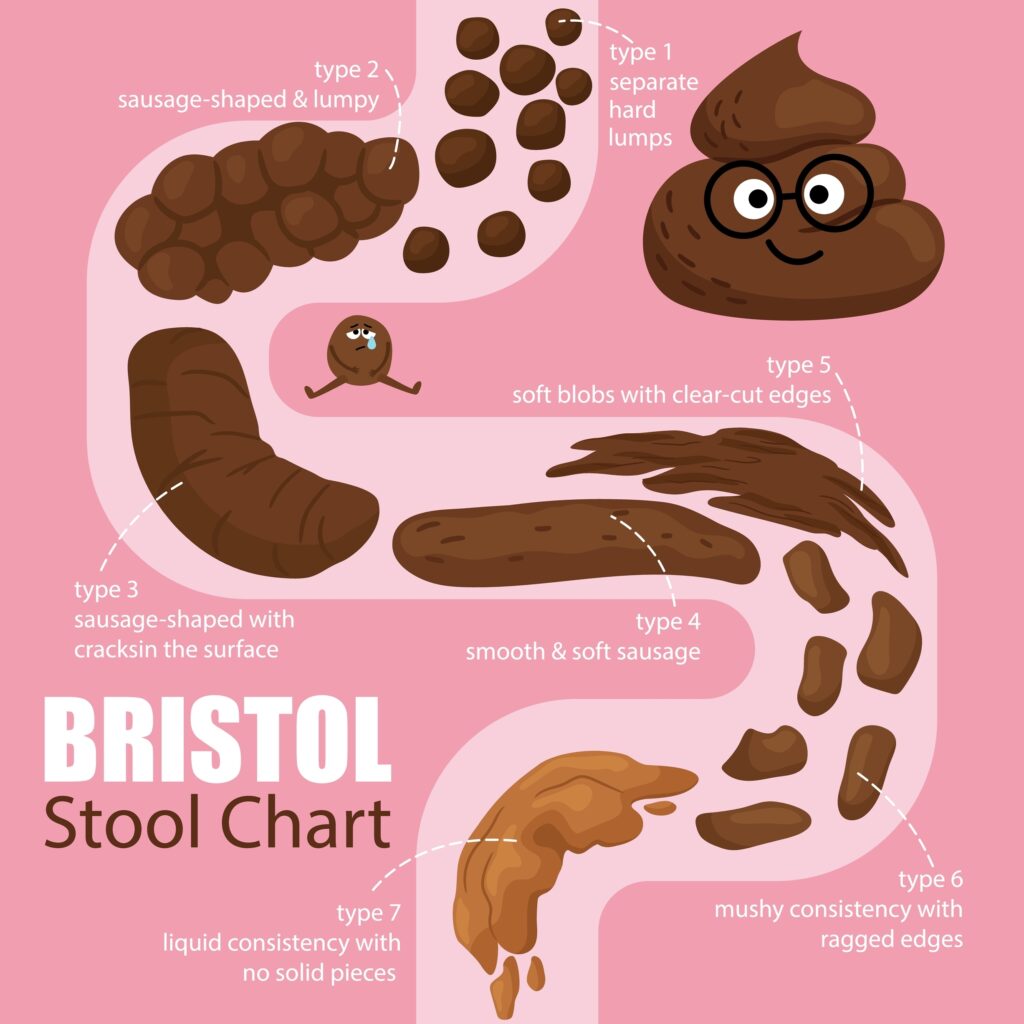 Vector isolated cartoon illustration on white of a set different types human feces, excrement in normal and diseases of diarrhea and constipation. A scale with information for correct diagnosis.