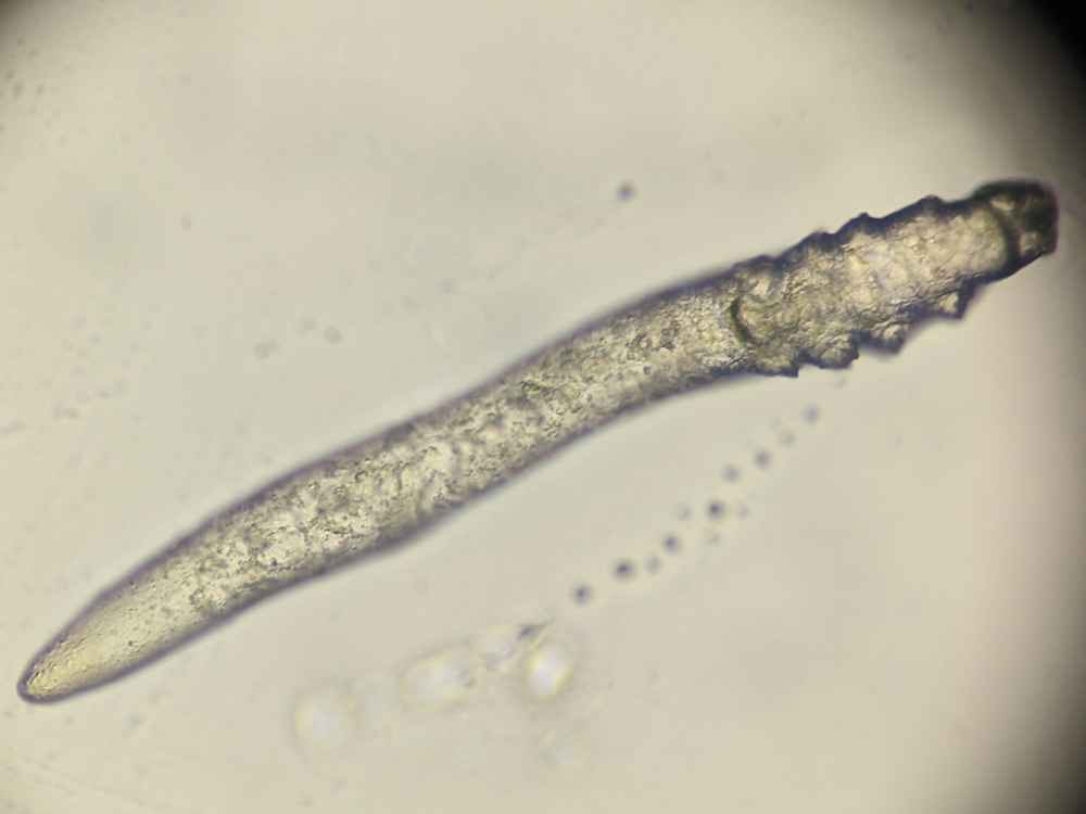 photo of demodex human face parasite under the microscope