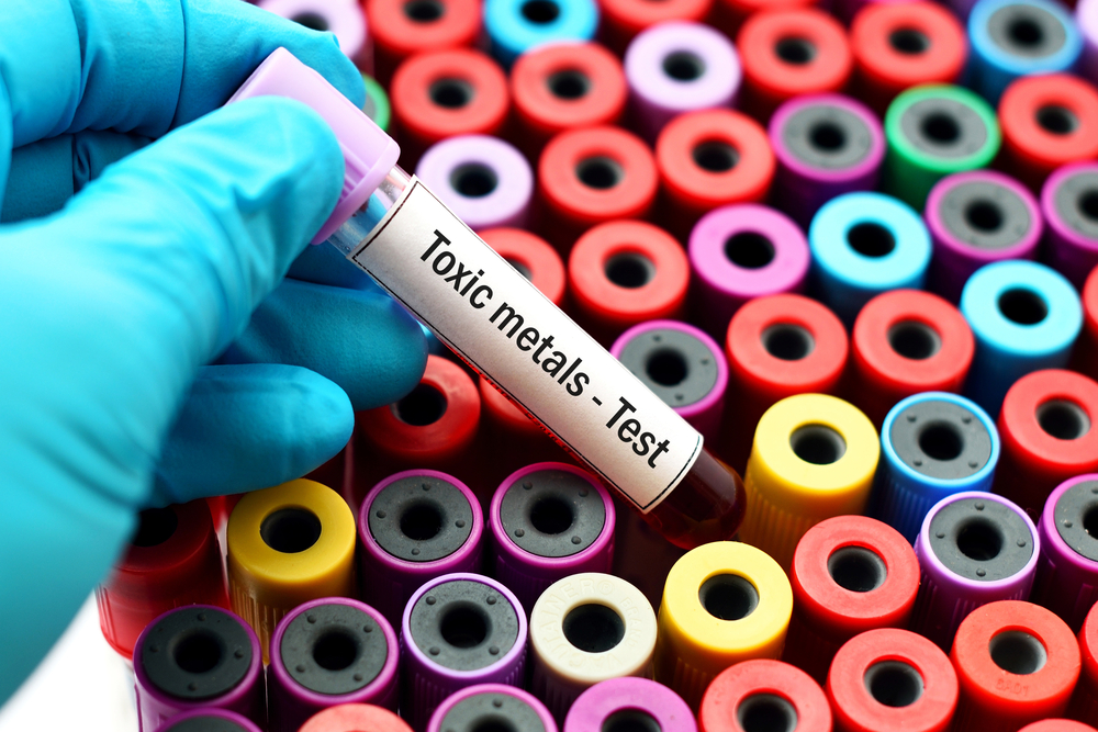 Toxic metals test
