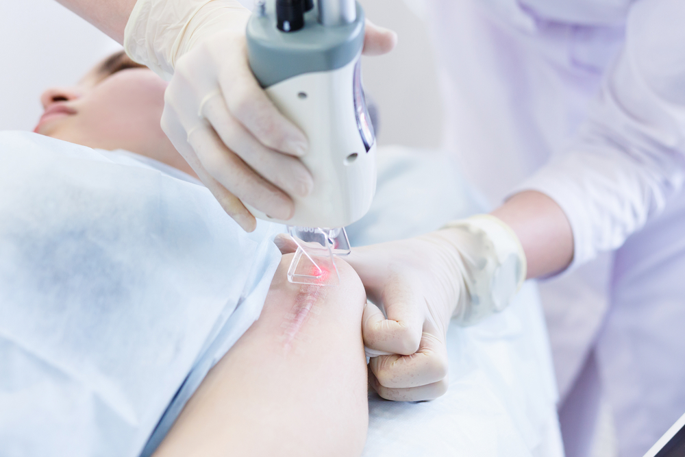 Woman getting a laser skin treatment or Laser resurfacing of scars in a skincare cosmetology clinic. Resurfacing technique for wrinkles, scars and solar damage to the skin