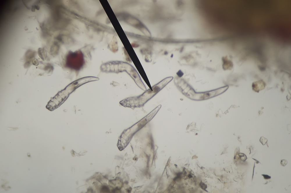 Demodex parasite under the skin in dog take a photo from microscope