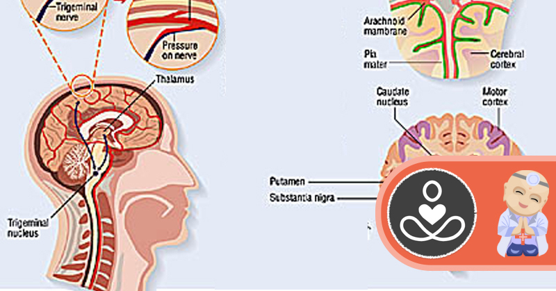 10 Natural and Effective Treatments For Headache and Migraine Relief