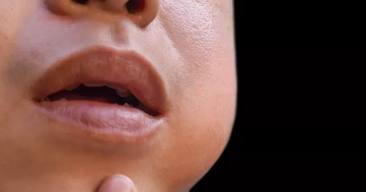 Having a Bad Taste in Your Mouth is a Common Sign of This Oral Condition