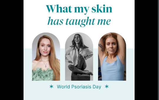 what my skin has taught me Instagram picture