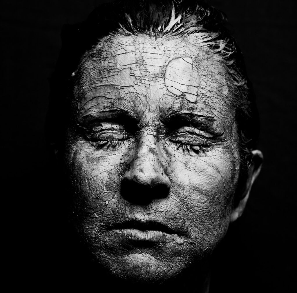 Black and white close up of a woman with dry skin.