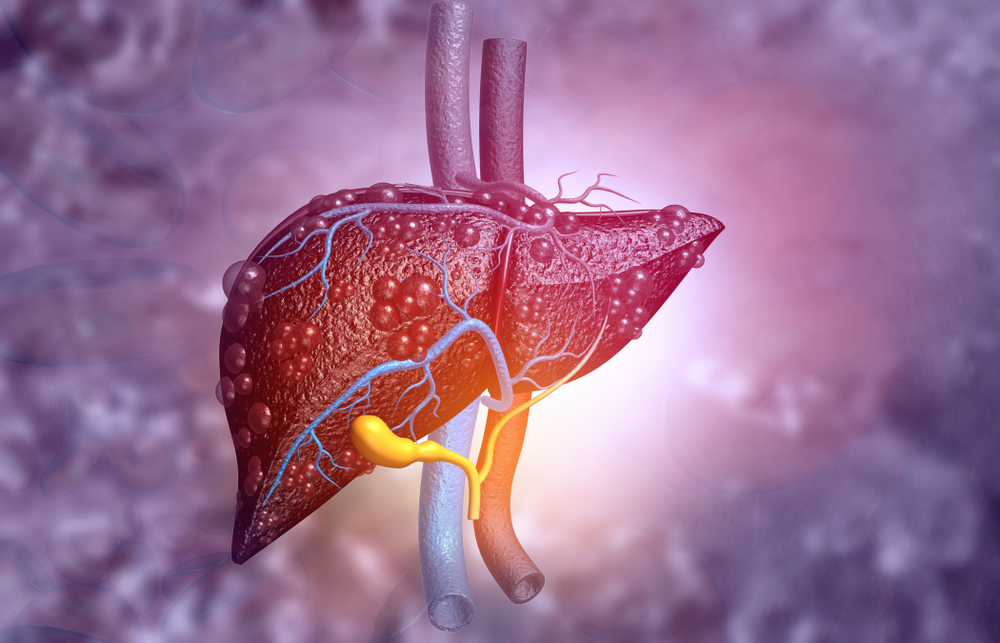 3d illustration of Abstract medical background with Diseased liver