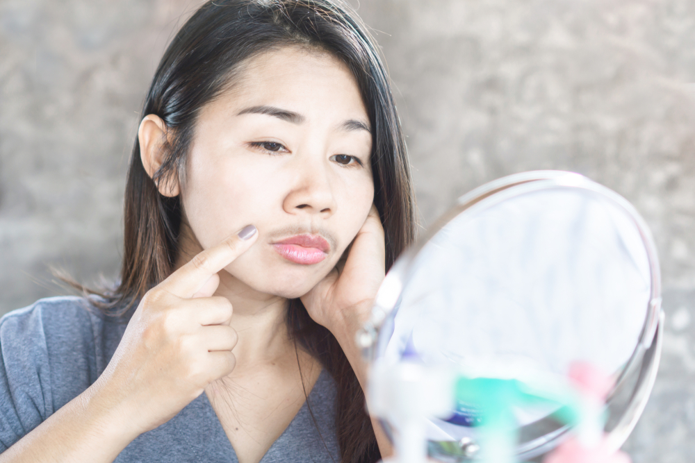 unhappy Asian woman having problem with mustache growing on face