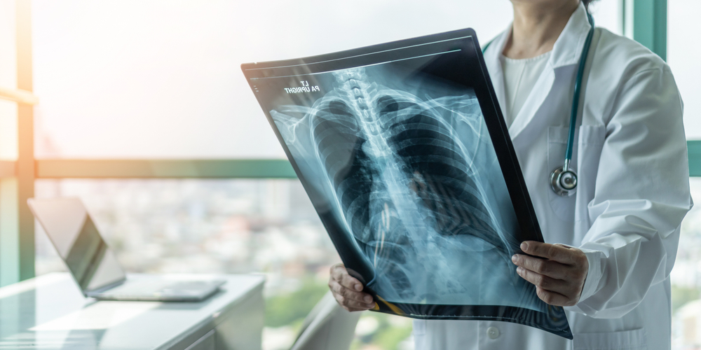 Doctor diagnosing patient’s health on asthma, lung disease, COVID-19, coronavirus or bone cancer illness with radiological chest x-ray film for medical healthcare hospital service