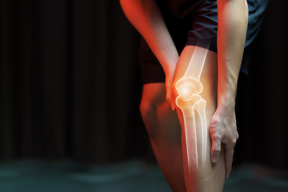 Medical concept, man suffering  with knee painful - skeleton x-ray, 