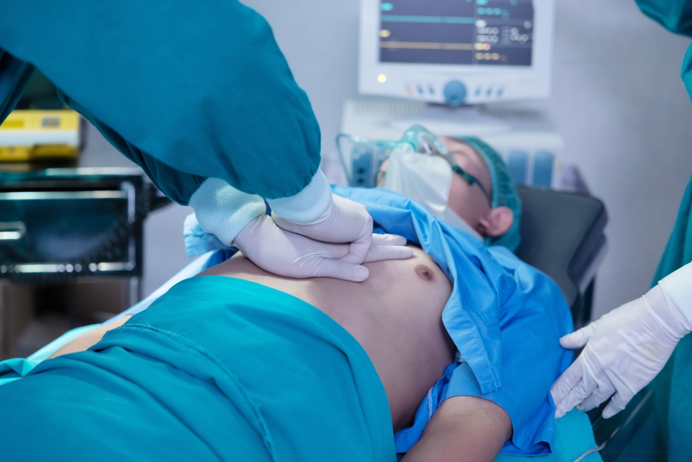 Close-Up on Asian Surgical Team Performing CPR on Heart Attack Patient in Hospital Operating Room