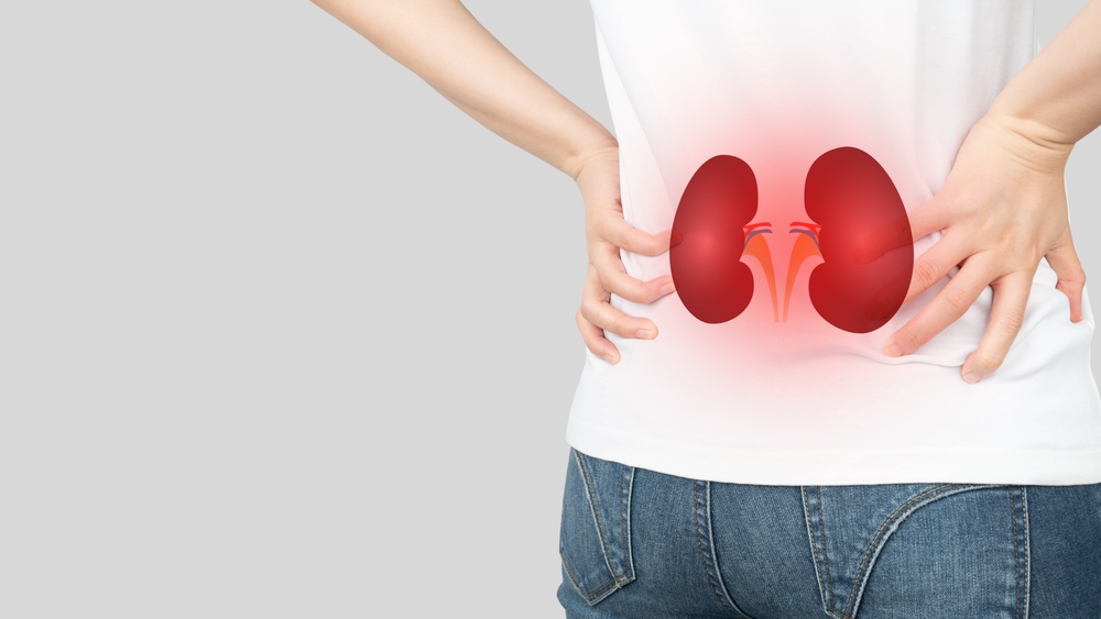 Woman suffering from low back pain with kidney anatomy shape. Cause of flank pain include urinary tract infection, kidney infection, kidney stone, an injury or kidney cancer. Nephrology concept.