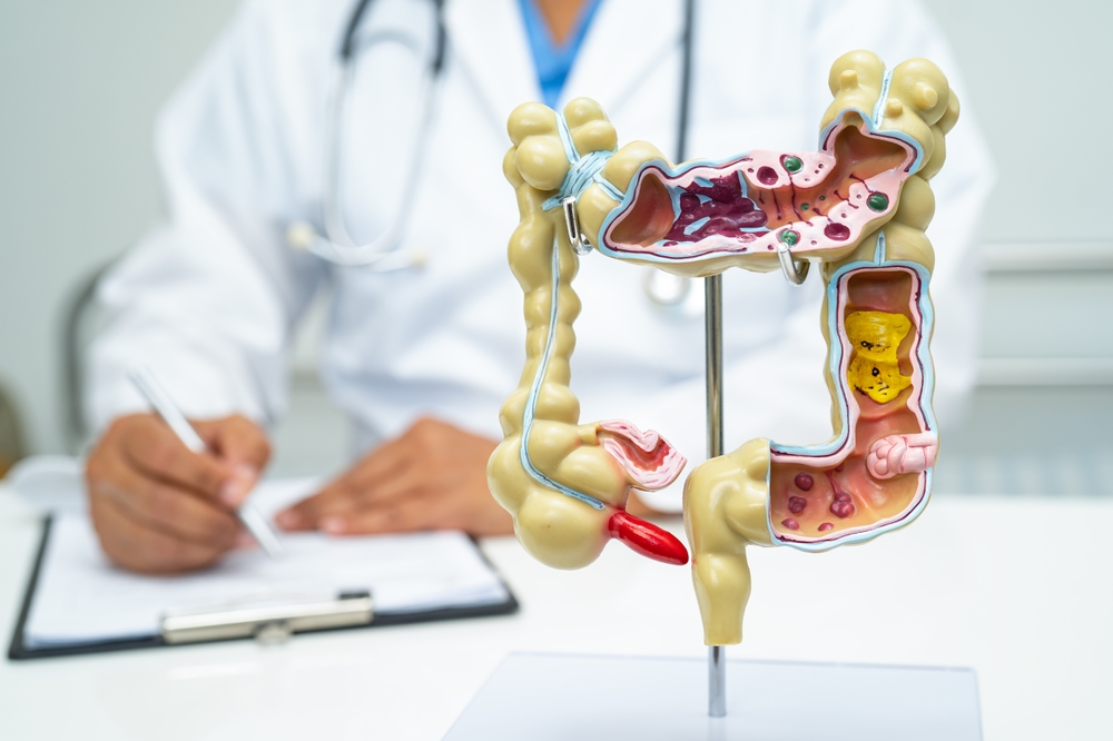 Intestine, appendix and digestive system, doctor holding anatomy model for study diagnosis and treatment in hospital.