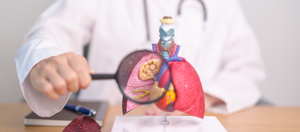 Doctor with Smoker Lung anatomy with magnifying glass. Lung Cancer, Asthma, Chronic Obstructive Pulmonary or COPD, Bronchitis, Emphysema, Cystic Fibrosis, Bronchiectasis, Pneumonia and world Lung day