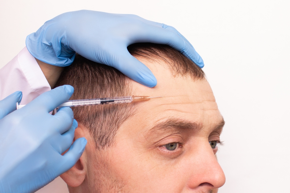 A cosmetologist injects botulinum toxin into a man with deep wrinkles on the forehead and around the eyes. Age-related changes on the face. Beauty and skin care concept. Treatment in the clinic