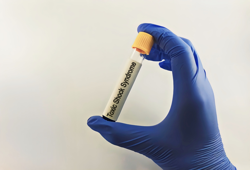 Toxic Shock Syndrome. Toxic Shock Syndrome disease blood test in doctor hand
