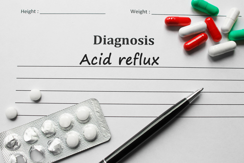 Acid reflux on the diagnosis list, medical concept