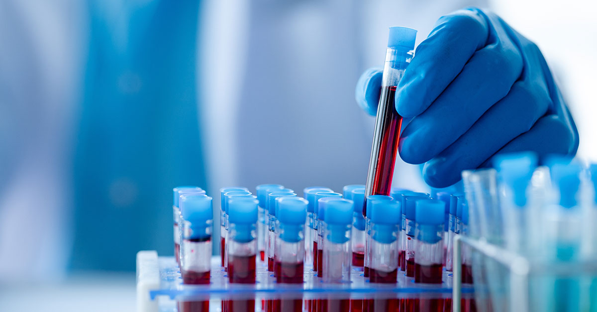 Which Blood Type is The Rarest? Here Are The Least to Most Common Blood Types